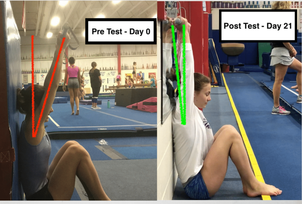 Gymnastics Back Pain 5 Easy Screens to Detect Problems